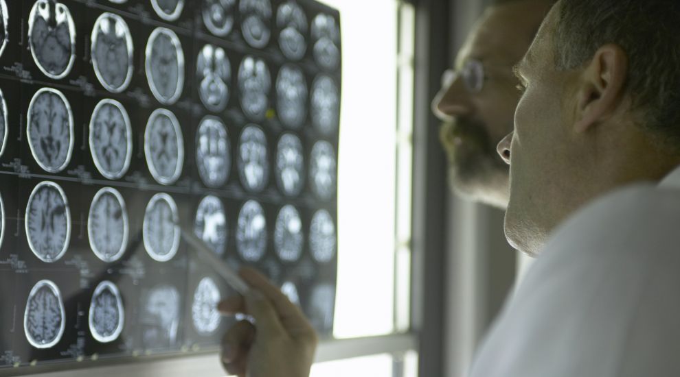 AI could spot Alzheimer’s in MRI scans up to a decade before symptoms show