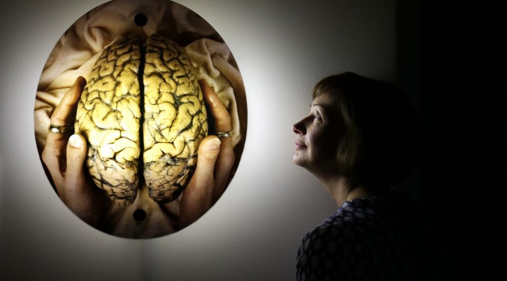 Researcher warns of hackers 'brainjacking' medical implants