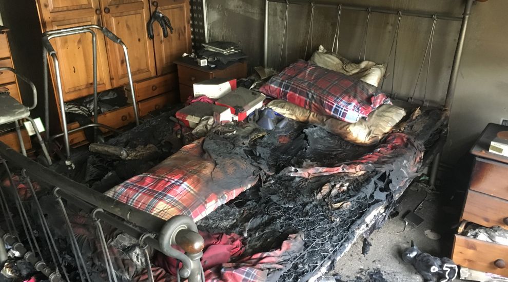 Elderly woman treated for burns after bedroom blaze